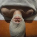 블르바드 | 강남 피부관리, 청담 신부관리 안면축소 윤곽관리 만족 후기 - 뷰티블르바드