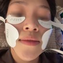 엔파로 | [논현동 피부과] 페이스 피트니스 엔파인더스 엔진리프팅 - 병원에서 얼굴 PT 받기 / 전 후 차이