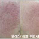 송은미스킨케어
