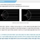 [ASA라섹잘하는병원GS안과] 초고도근시를 위한 최적의 수술 ASA PLUS+라섹교정술 이미지