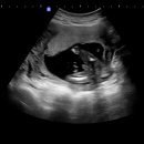 세인트여성의원 이미지