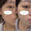 단아한 | [부산 남천] 예비신부 웨딩관리 추천✨ 단아한 에스테틱 얼굴윤곽관리 후기