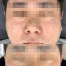 교방동113 | 창원 모공 관리로 개선이 되는곳