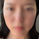 조이앤픽 | 잠실피부관리 경락 조이스킨앤스파에서 윤곽관리 60분 받고 온 찐후기