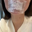 어린공주성형외과의원 | 입술필러 맛집 어린공주 성형외과 리뷰