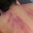 혁신LH1단지상가동 | 나주혁신도시 빛가람동 가성비 등 관리(수기+기기)후기, 김은숙피부관리