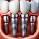 대원치과의원 | 안양시 만안구 임플란트 치과 잘하는 곳, 가격 비용 싼 곳 BEST10 추천