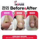 둔산중로-50 | 대전발톱무좀 후기 확인 후 관리해보세요!