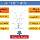 경희예가한의원 | 정복하기 3 - 원형탈모 유발요인1 , initiating facter / 원형 탈모 전문 명동탈모 더봄한의원(舊 경희봄)