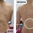 성남출장마사지 이미지