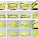 바른치과기공소 이미지