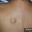연세화산외과 이미지