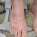 베어네일(Bear nail) | 진주 발톱무좀 내성발톱 관리 여기 추천! 후네일 &amp; 베어진주장대점