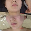 고선생뷰티살롱 | 송도피부관리 '고선생 뷰티살롱' 데콜테+V라인 후기 20년 경력의 미친 손맛!