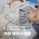 뷰커스의원 듀얼토닝 피코슈어+줌패스 레이저 후기
