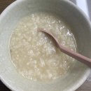 덕천굿윌치과에서 매복사랑니 발치 후기(1)-TMI
