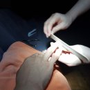 서초 양재동 마사지 테라피 추천 [다낭베트남케어샵] 베트남 황제케어 귀청소 힐링