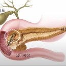 췌장암과 폐암의 발현 조건과 대처 방안은 무엇인가 ? ​ 이미지