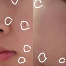 압구정에이블의원
