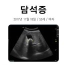 셀빙강내과의원 네이버블로그