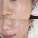 물빛스킨케어 | 광주 주월동 피부관리 물빛스킨케어 웨딩관리로 트로이필 받기