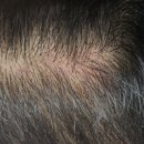 시크릿바비 | 탈모관리 제대로 하는 곳! 커트펌염색 동시가능- 두피앤헤어 [시크릿바비뷰티 거창점]거창함양두피관리