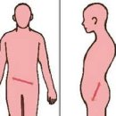 대전 퍼스널트레이닝 스파랜드 ,골반틀어짐 자가 진단법 이미지