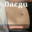 이한메디칼 | 대구수성구범어동바디관리 예신관리 에르벨에스테틱