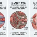 어깨 뭉침과 미운 팔뚝 살, 얼굴라인"겨드랑이"에 답이 있다. 그 이유?