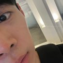 중앙땅콩 | 서울 강남피부과, "미희주사 후기" 콜라겐부스터로 옆볼패임 땅콩형 얼굴 개선