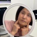실루엣소프트 실리프팅 후기 50대 엄마 얼굴 처짐 개선과 유지기간