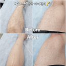 남구-81 | 울산 남구 신정동 왁싱스팟 1인샵 남자 다리전체 슈가링 하드 선택가능
