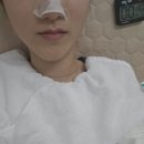 지우메디 | 울산 삼산피부관리 데자뷰메디스킨 상세후기