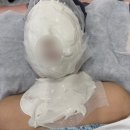 보경 | [안산피부관리샵] 고잔동에스테틱 보경뷰티 | 편평사마귀, 기미 제거 후기