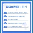 푸른메디칼의원 | 일산안과 잘하는 곳, 결막에 생기는 주름, 방치하면 처짐까지?