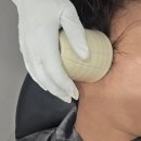 조엄로 | 문제성두피&amp;탈모로 고민이라면? 모블리스 두피케어 리얼 후기