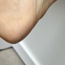 푸름약국 | 건조한 겨울철 발관리, 고운발 풋크림으로 달라질까? 솔직 후기