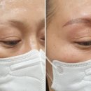 고은하늘성형외과 네이버블로그