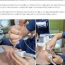 어깨 석회성건염 원인 증상 통증 치료 주사 스트레칭 이미지