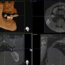오랄치과기공소 이미지