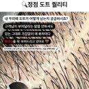조헤어라인 이미지