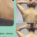 좋은두피 풀림