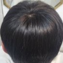 대구가발 잘하는곳 김호증모가발 대구 체인 헤어슈 방문 후기입니다!