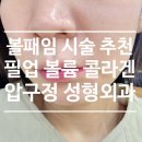 필업 | 압구정성형외과 필업 볼륨콜라겐 볼꺼짐 만족 후기