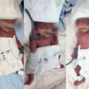 1의기적