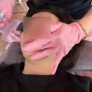 구미피부관리 구미화이트닝 형곡피부관리 플라즈마후기 •카리테스뷰티•