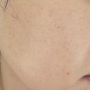 미니라이브 | 뷰티디바이스 미니튠 쿼드쎄라 사용 후기,역대급 쇼핑라이브 방송 혜택
