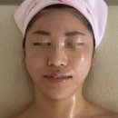 더 뷰티 독 | [연신내 피부관리] 안은경 뷰티어겐 후기