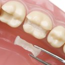 예인치과 이미지