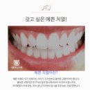 서울미래치과의원 네이버블로그